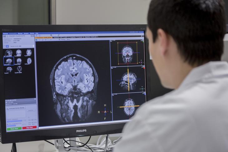 Els portadors del gen d’APOE ε2 poden tenir una reserva cerebral més gran i millor protecció contra l’Alzheimer